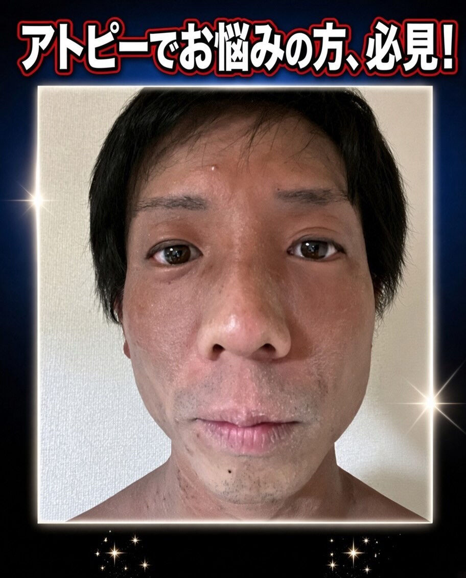 【カイロプラクティック】【埼玉県川口市】